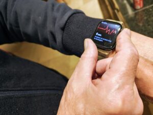 Elektrocardiogram Apple Watch